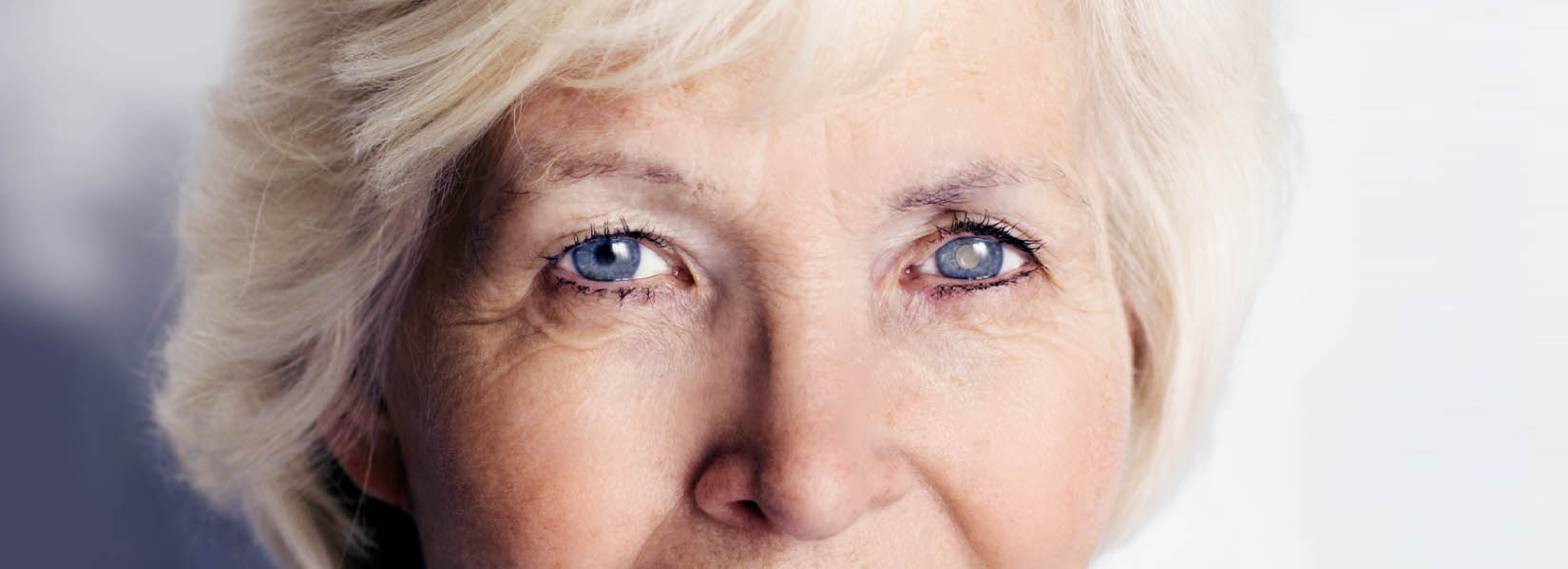 Cataract Surgery in St. Cloud