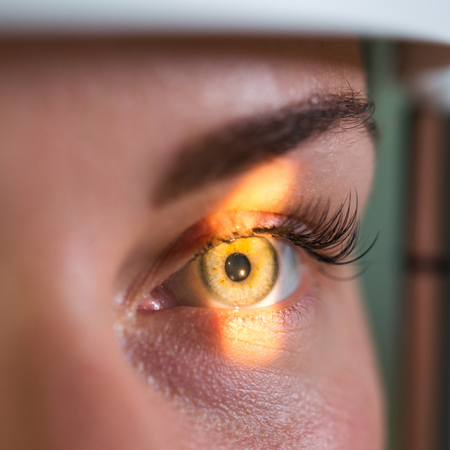 Vision Therapy in St. Cloud